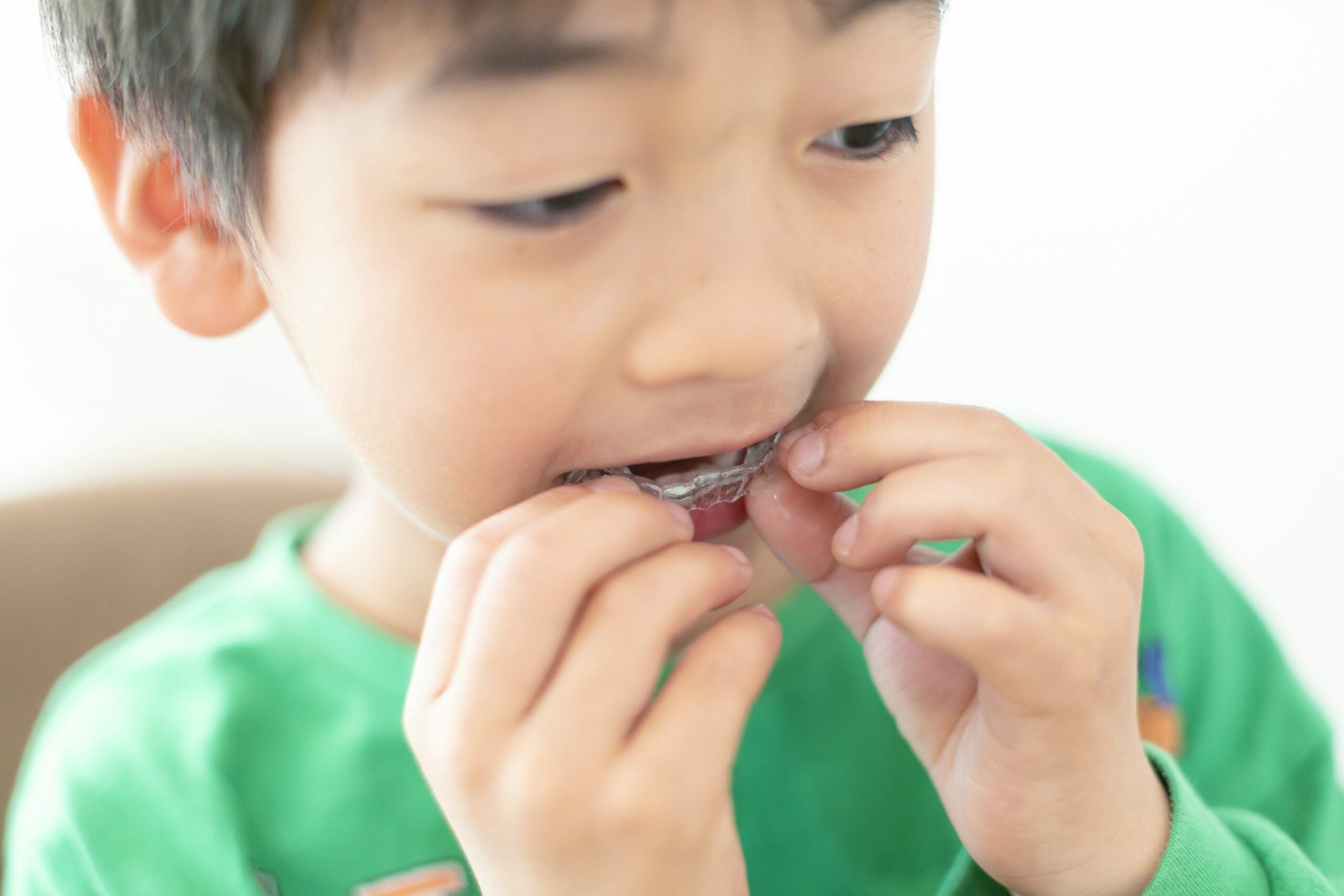 小児矯正マウスピース